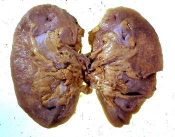 KIDNEY